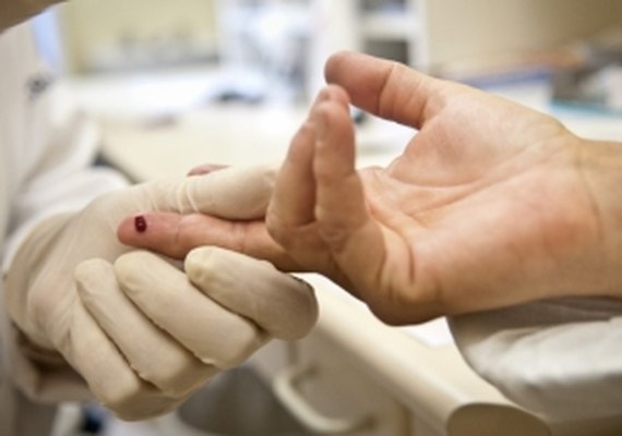 Teste rápido de HIV deve ser vendido nas farmácias a partir de fevereiro