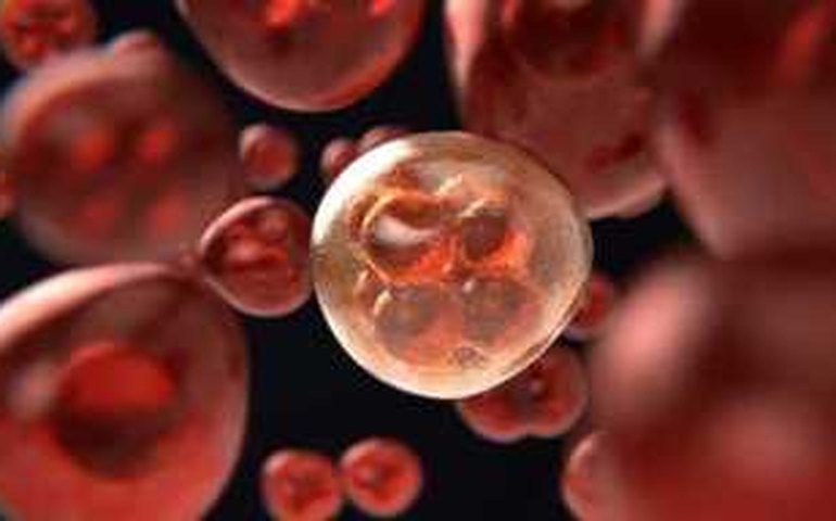 Ao menos 50 mil brasileiros deixaram de ser diagnosticados com câncer