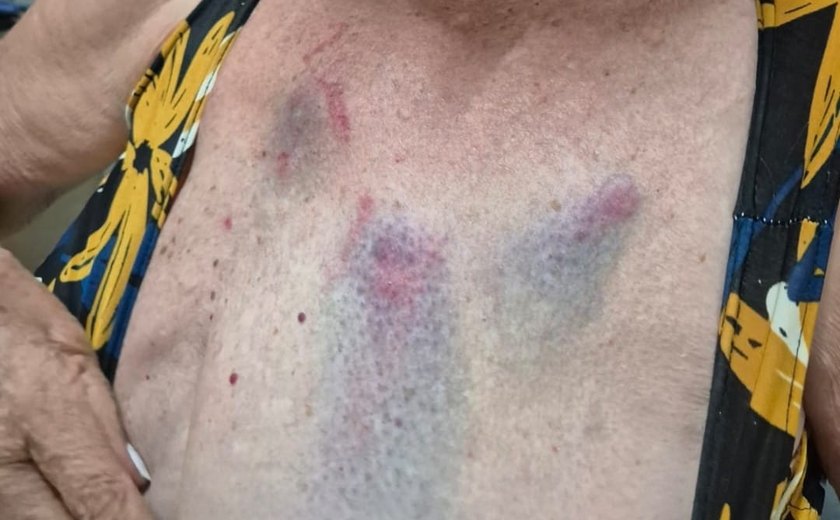 Médica é presa em Arapiraca por agredir tia idosa e descumprir medida protetiva