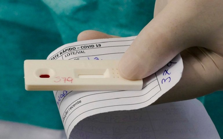 Ministério da Saúde anuncia a aquisição de 46 milhões de testes para diagnóstico da Covid-19