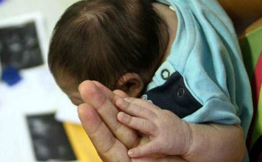 Pesquisa liga dieta pobre de mãe com zika a microcefalia
