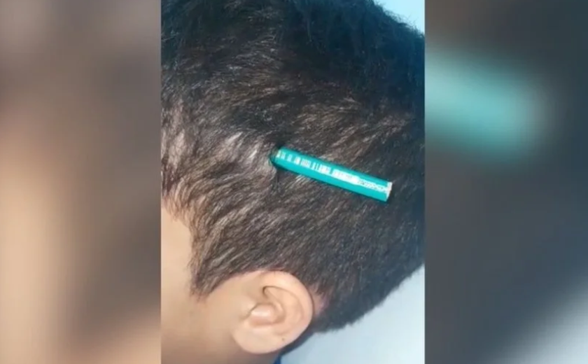 Estudante finca lápis na cabeça de colega durante briga em escola no litoral de São Paulo