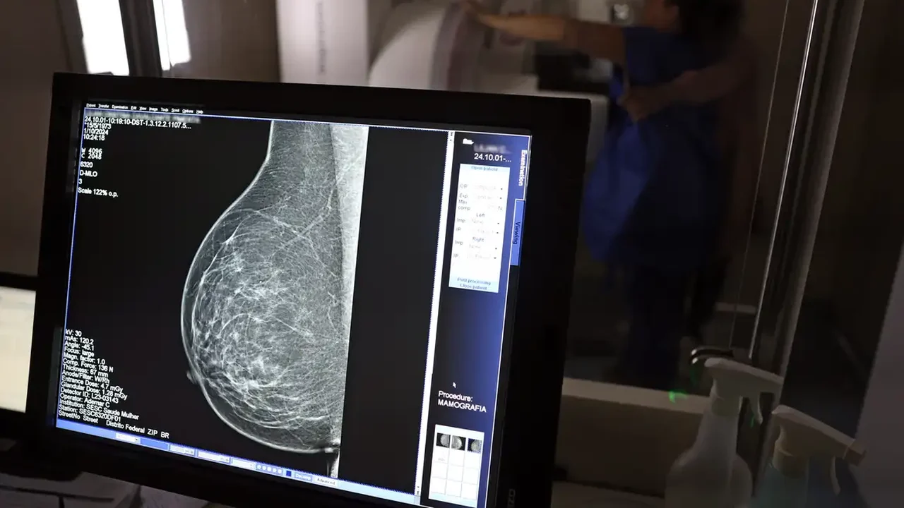 Sesau promove mutirão de mamografias para reeducandas do Presídio Feminino Santa Luzia