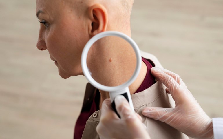 Brasil sediará testes de nova terapia contra o câncer