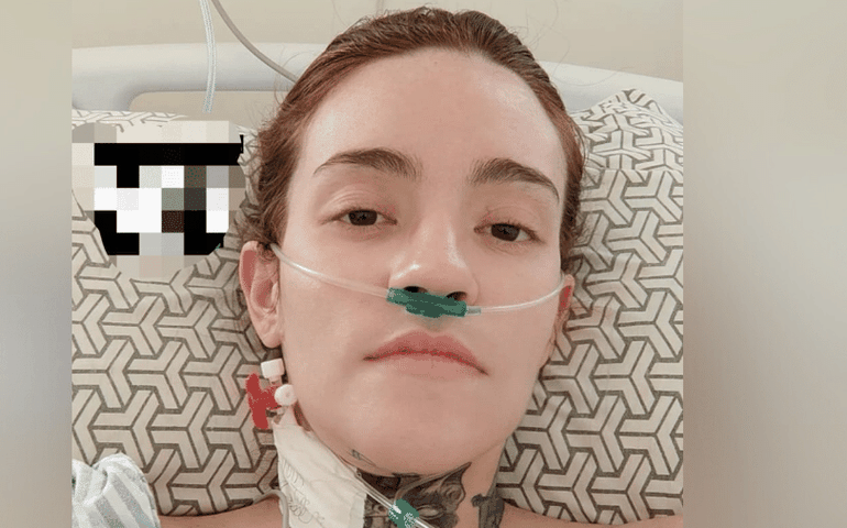 Neuralgia do trigêmeo: 'pior dor do mundo' diminui após jovem passar por novo procedimento