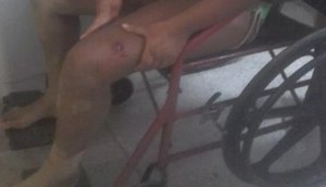 tiro de raspão