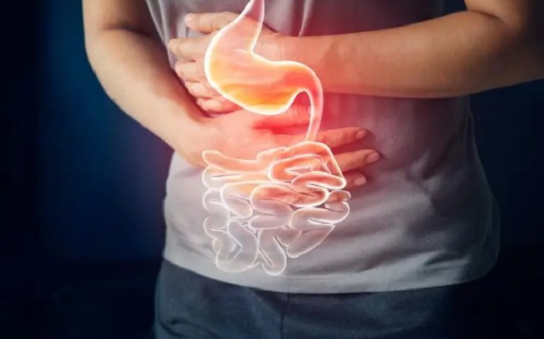 Corante vermelho aumenta risco de doença no intestino