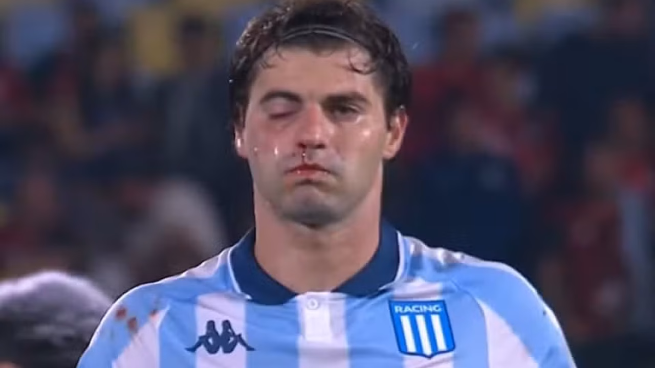 Rocky, Street Fighter: rosto 'detonado' de Sosa viraliza após derrota do Racing para o Flamengo