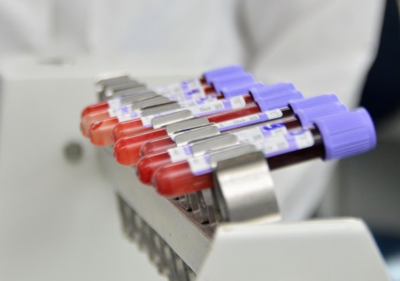 Hemoal promove nesta segunda cadastro para doação de medula óssea no Maceió Shopping