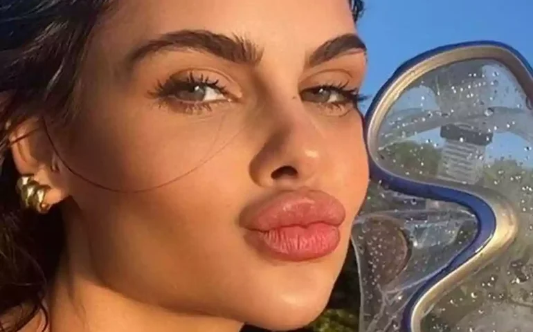 Antes e depois: Amanda Kimberlly já passou por reality show e namorou músico