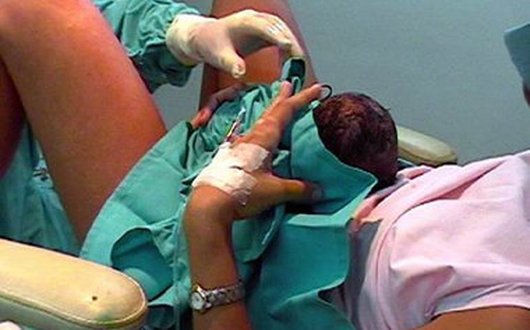 MPAL instaura procedimento para averiguar a regularidade de Episiotomia durante o parto em hospital do Sertão