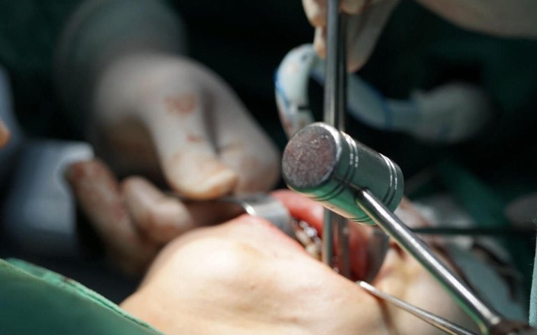 Hospital Regional do Norte é o primeiro da Rede Pública do Estado a realizar a cirurgia ortognática