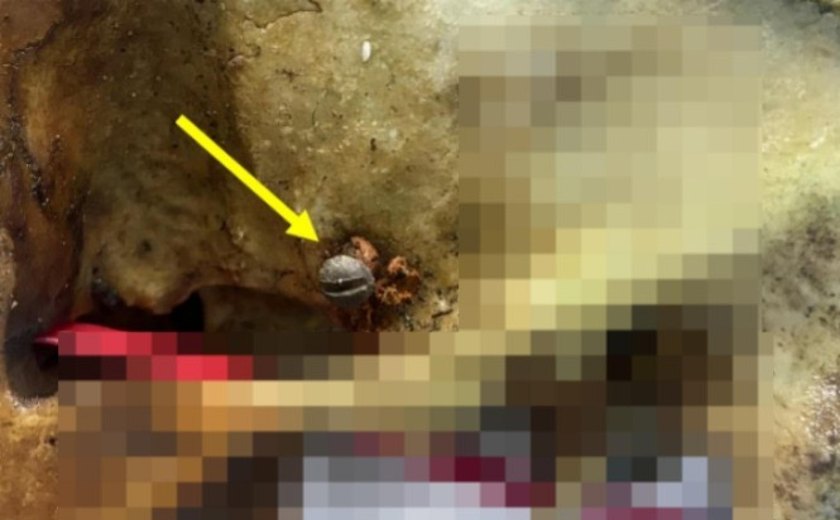 Polícia Científica conclui exames no crânio encontrado de Mar Vermelho