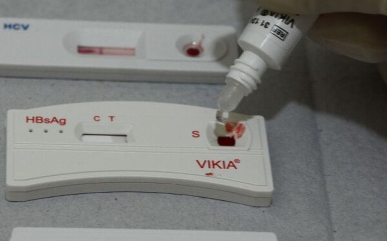 Falar de sífilis sem preconceitos é tema de exposição em Niterói