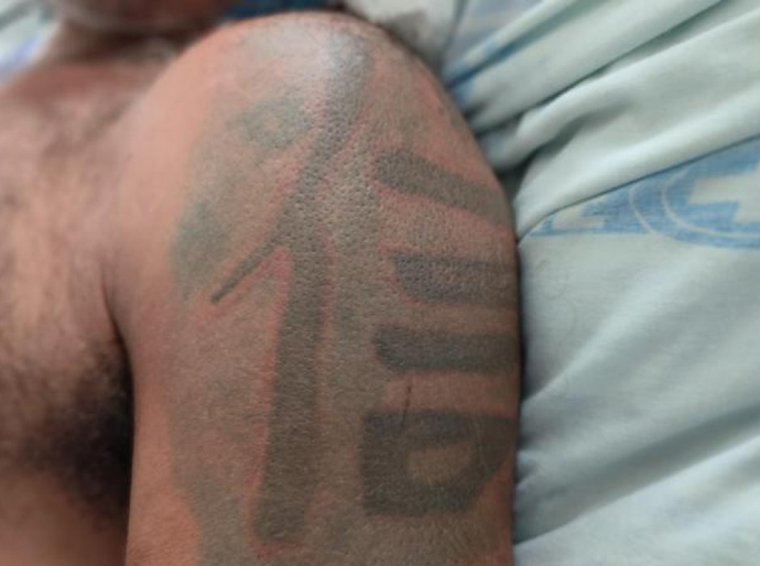 Hospital de Emergência do Agreste tenta localizar familiares de paciente sem identificação