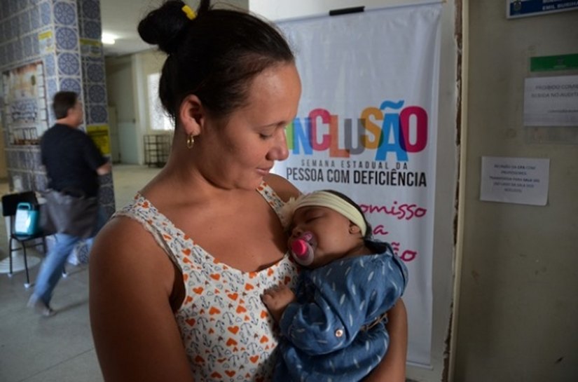 Microcefalia: Sesau realiza seminário sobre cuidado com as crianças