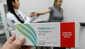 implanon / Foto: Foto: Rogério Capela/PMC