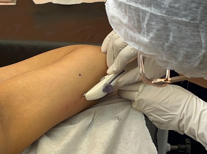 Secretaria da Primeira Infância promove capacitação para inserção do Implanon em Rio Largo