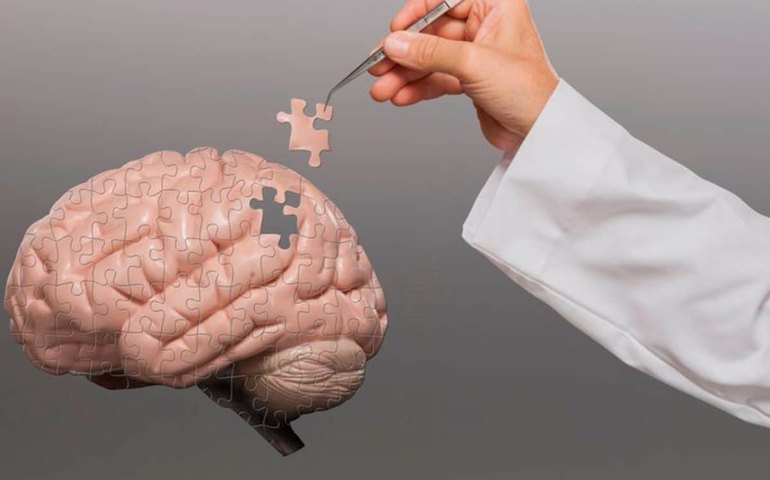 Cientistas defendem uso do Viagra para o tratamento do Alzheimer; entenda