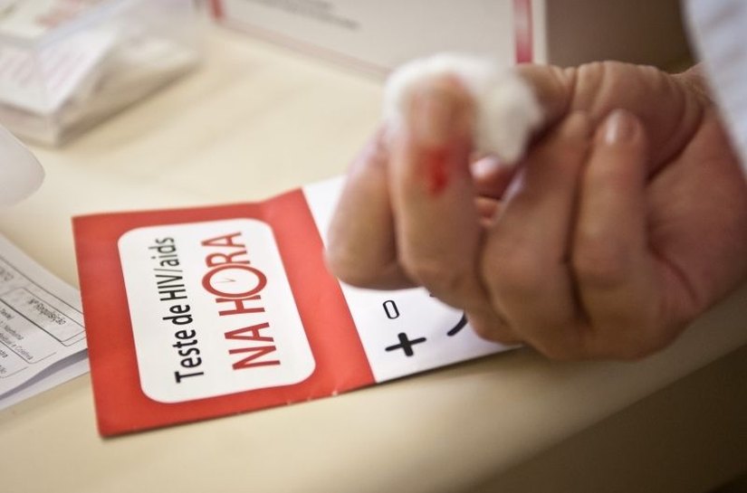 Vigilância Epidemiológica para Aids e HIV apresenta boletim 2016