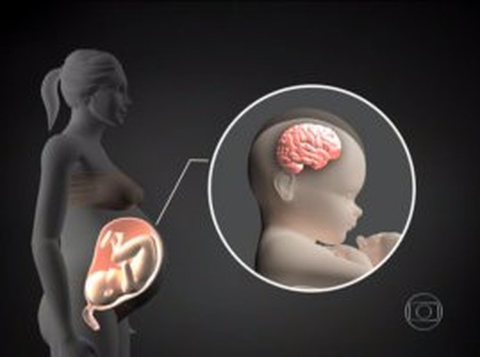 Secretaria de Saúde informa sobre situação de AL em relação aos casos de microcefalia