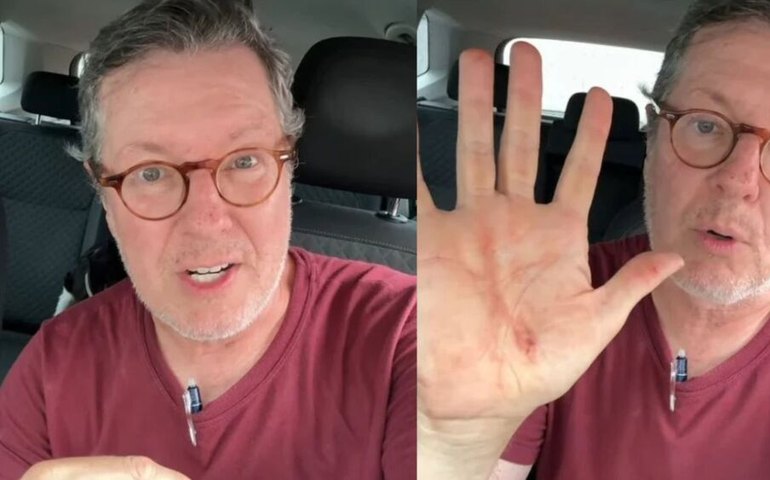 Márcio Gomes, âncora da CNN, se fere após tentativa de assalto na zona oeste de SP, veja relato