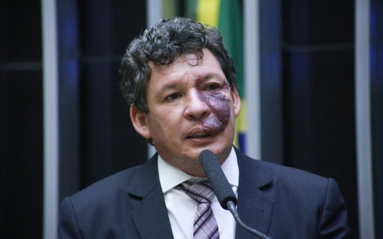 Lopes: PEC é início de debate sobre combinar lei fiscal com metas sociais