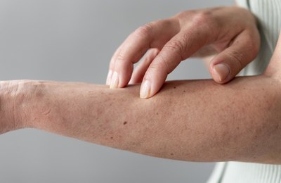 Síndrome de Alagille: doença rara impacta saúde mental e financeira