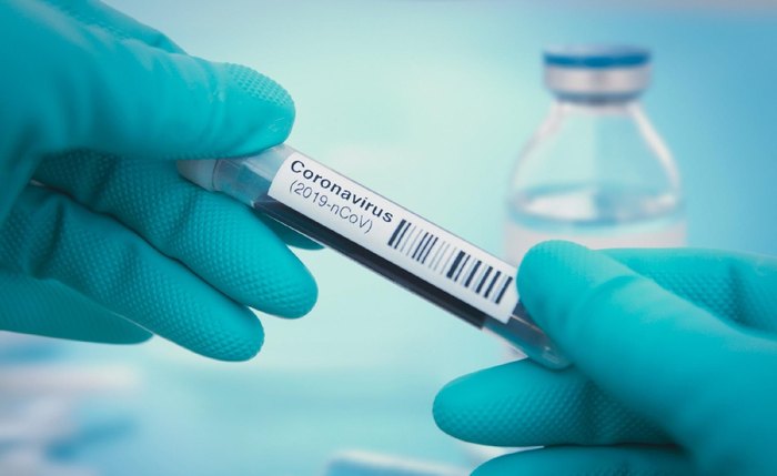 Testes para coronavírus