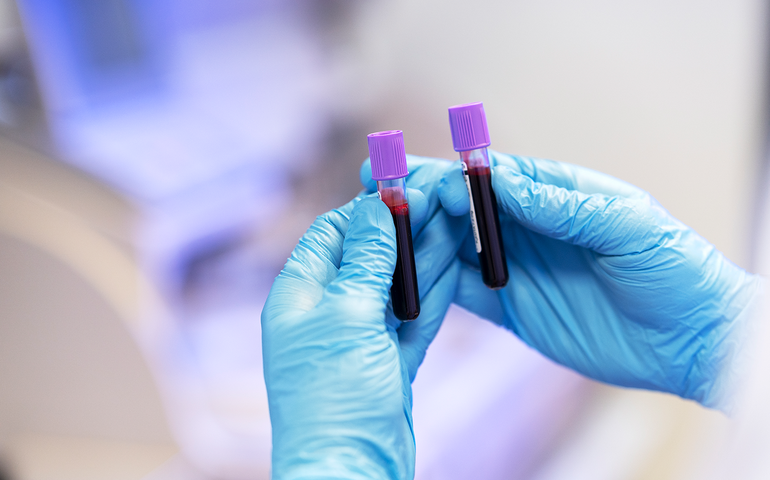 Aumento de casos de sífilis preocupa autoridades em Goiás