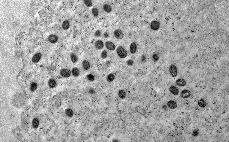 Mpox: Argentina põe em quarentena navio que deixou Brasil