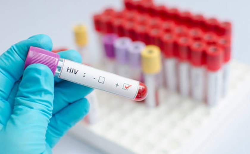 Número de brasileiros com o vírus HIV ainda cresce no Brasil