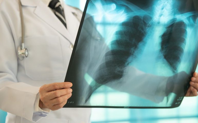 Comissões debatem impacto da doença pulmonar obstrutiva crônica na população idosa