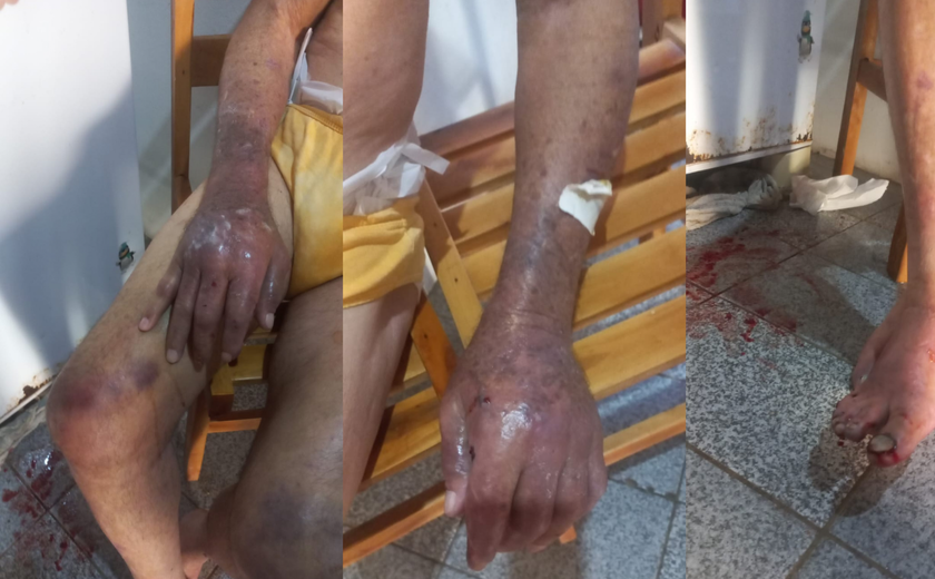 Filha é presa suspeita de maus-tratos após idoso ser encontrado em situação de risco no interior de Alagoas