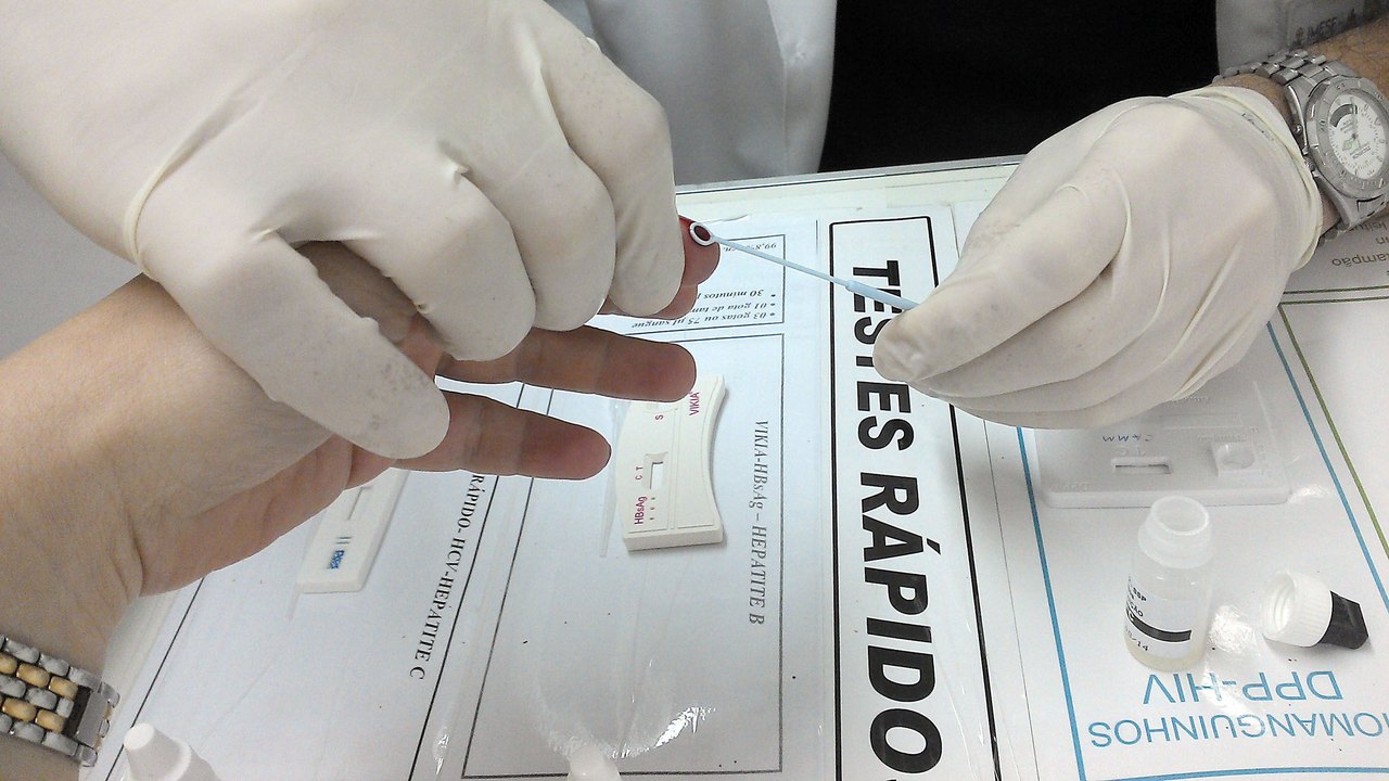 Jequiá da Praia implanta teste rápido para HIV, Sífilis e Hepatite em todas as Unidades de Saúde