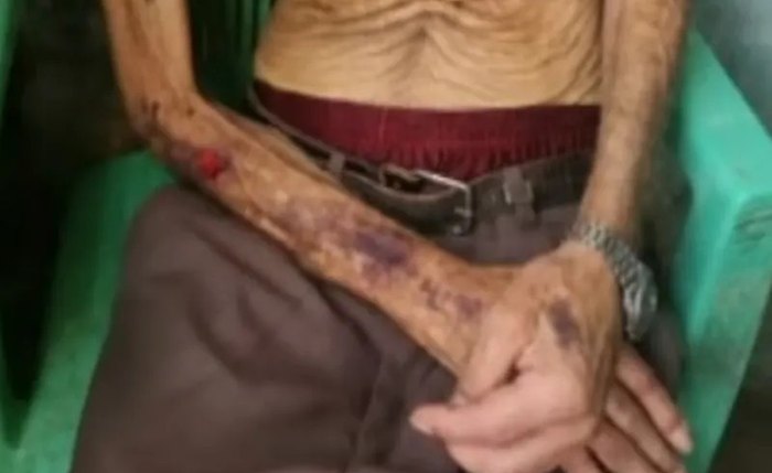 Idoso, cuja identidade foi preservada, foi resgatado debilitado e desnorteado