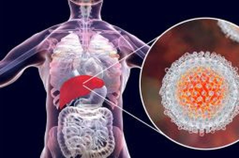 Julho Amarelo: Brasil registrou mais de 826 mil casos de hepatites virais; infectologista esclarece mitos e verdades sobre as doenças
