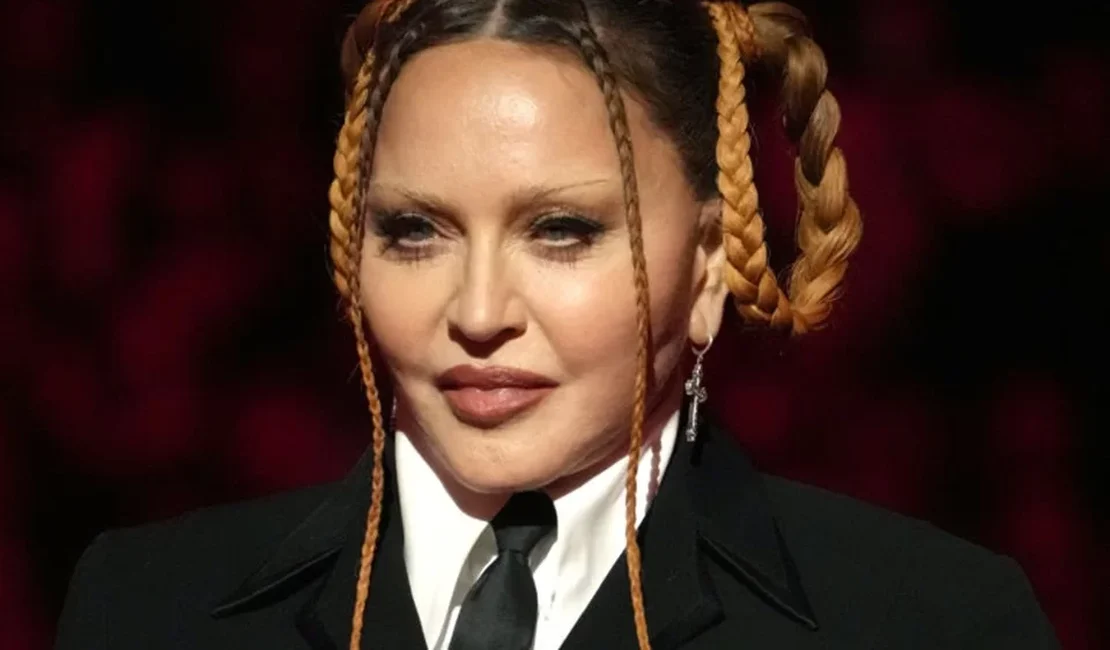 A aparência de Madonna desperta discussões sobre o medo de envelhecer
