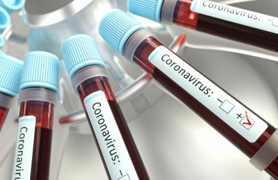 Casos de coronavírus aumentam e prefeitura pede atenção da população de Palmeira