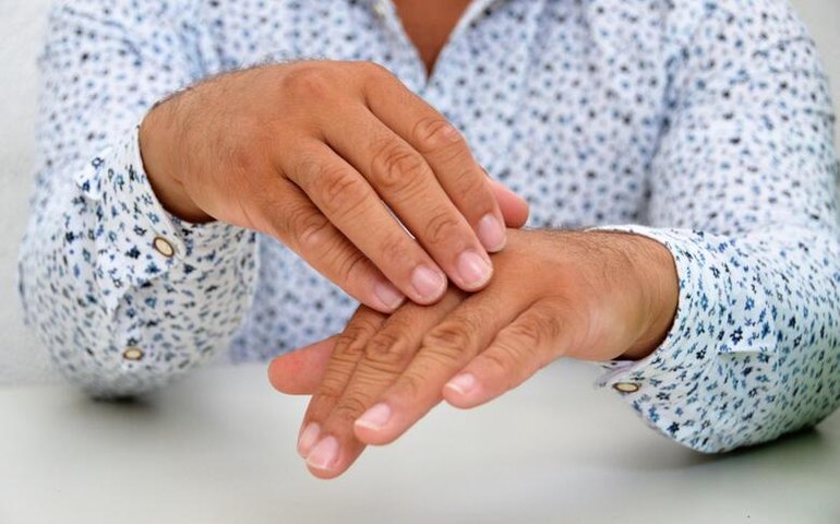 Sesau mantém alerta para diagnóstico precoce da Hanseníase, apesar da redução de casos