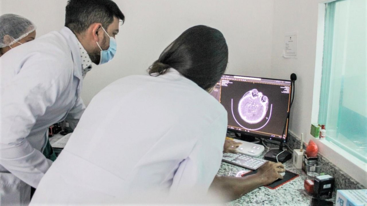 Programa ‘AVC Dá Sinais’ realiza primeira trombectomia mecânica em paciente alagoana