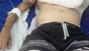 Entregador é espancado por seguranças de seresta e fica hospitalizado em Itabaiana