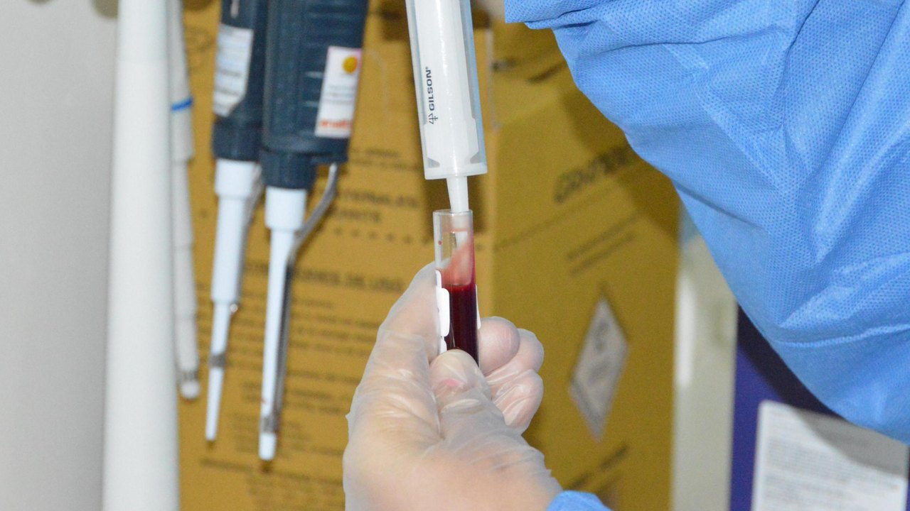 Sesau promove evento para discutir ações voltadas ao controle da doença meningocócica em Alagoas