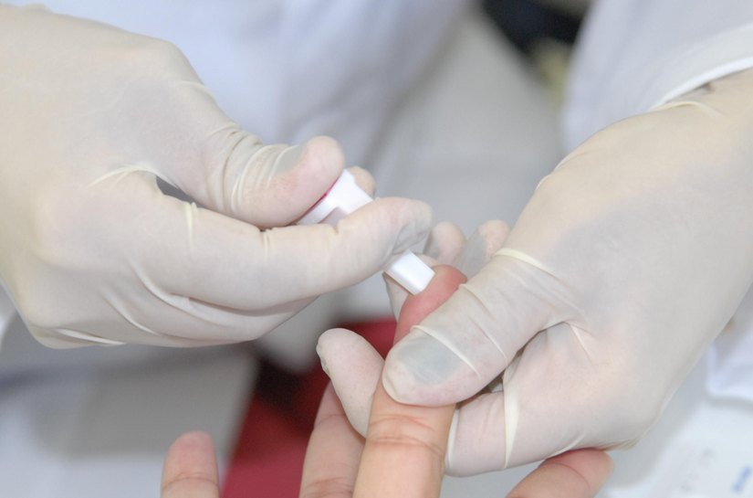 Julho Amarelo: Sesau orienta como prevenir, diagnosticar e tratar as hepatites virais