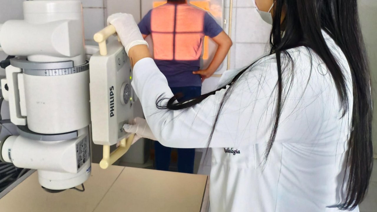 Hospital Helvio Auto intensifica ações de prevenção no Dia Mundial de combate à Tuberculose