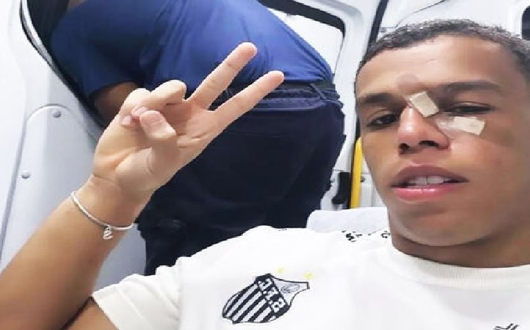 Volante do Santos sofre fratura no nariz e passará por cirurgia
