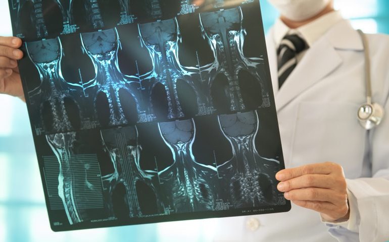 Comissão de Saúde discute combate ao câncer de cabeça e pescoço