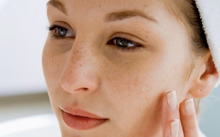 Atenção aos sinais: manchas e melasma são comuns durante a gravidez