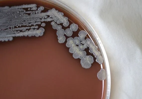 Bactéria rara encontrada nos EUA deixa autoridades de saúde em alerta