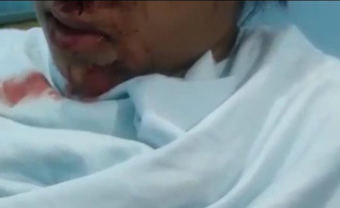 Jovem subiu na van na rodovia AL-105, na zona rural de Campo Jovem subiu na van na rodovia AL-105, na zona rural de Campo